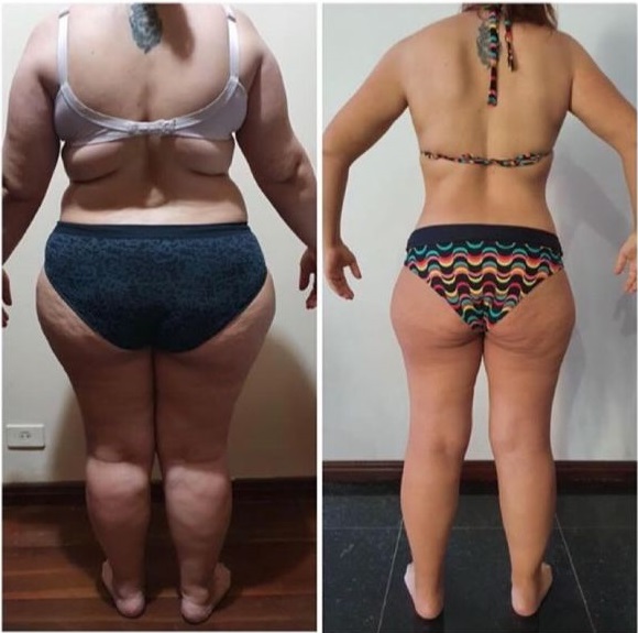 Antes e Depois