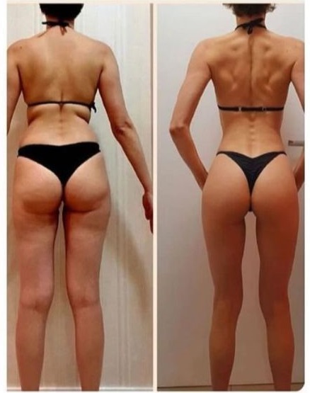 Antes e Depois