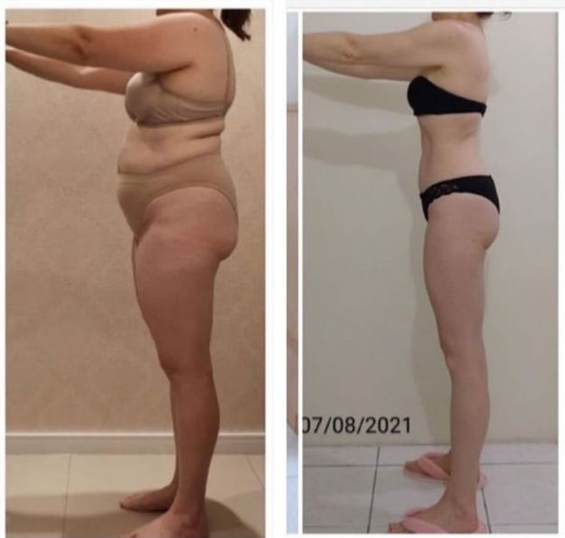 Antes e Depois