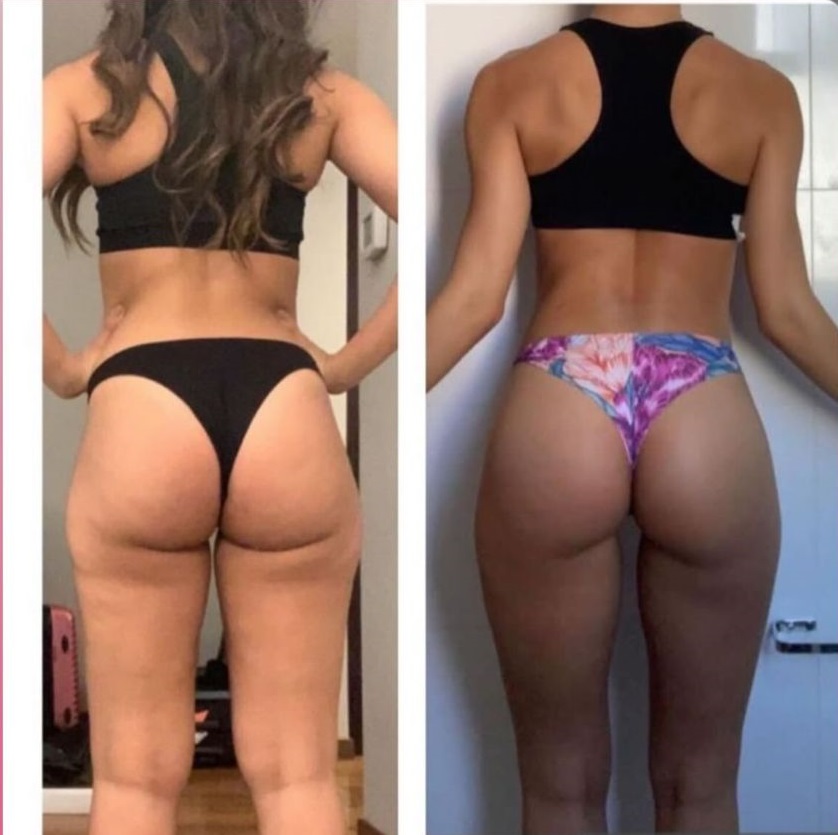 Antes e Depois