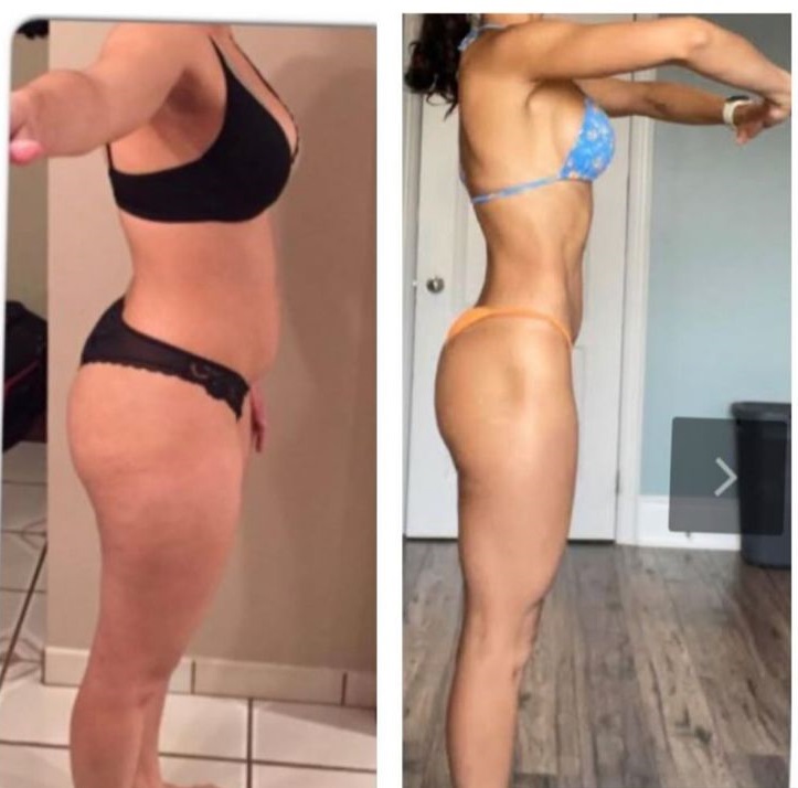 Antes e Depois
