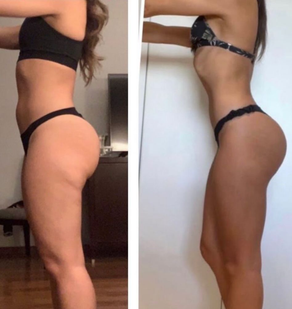 Antes e Depois