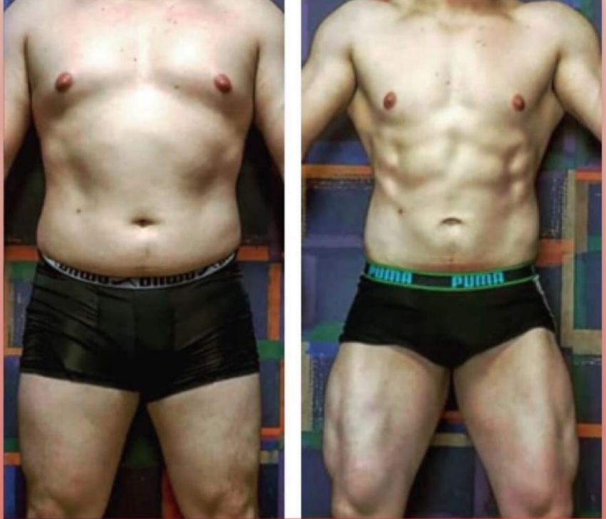 Antes e Depois