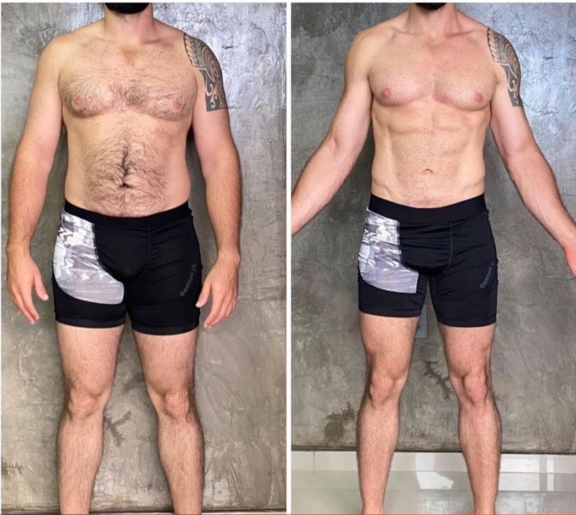 Antes e Depois