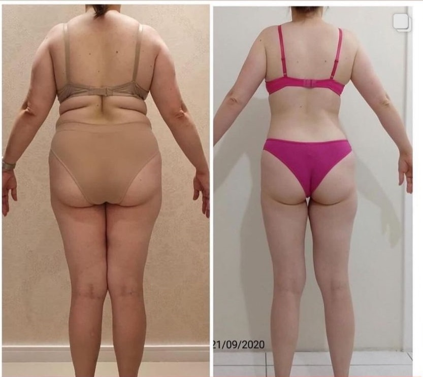 Antes e Depois
