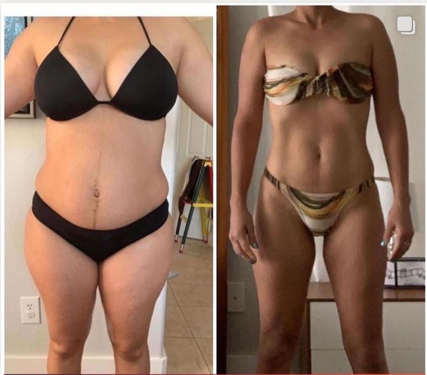 Antes e Depois
