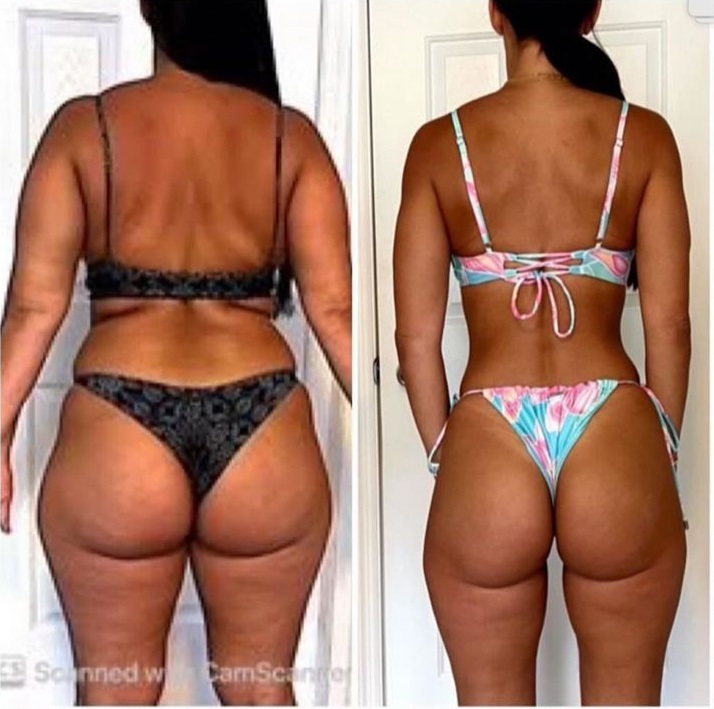 Antes e Depois