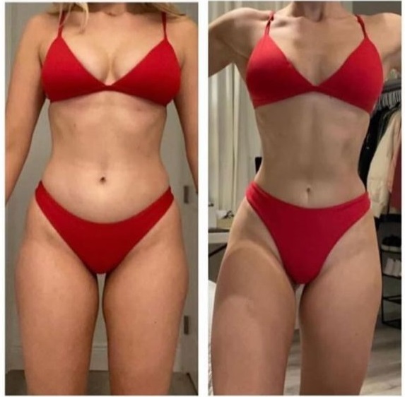 Antes e Depois